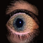 Dry Eye Treatment Center